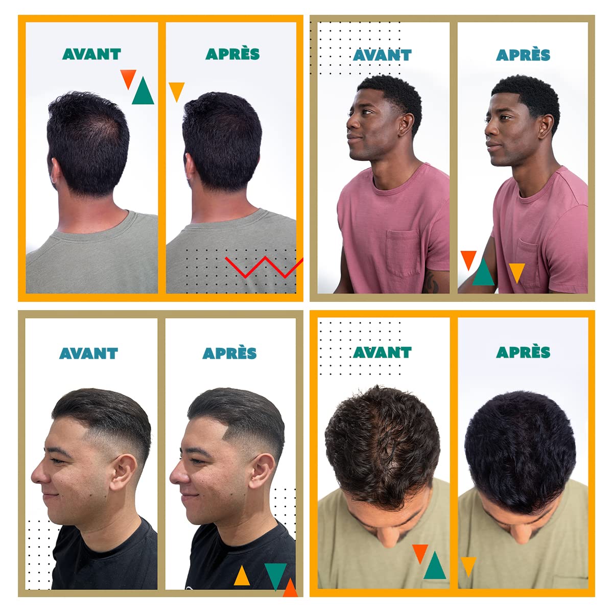 Toppik Hair Building Fibers, Medium Brown, 27.5g | Fill In Fine or Thinning Hair | Instantly Thicker, Fuller Looking Hair | 9 Shades for Men & Women